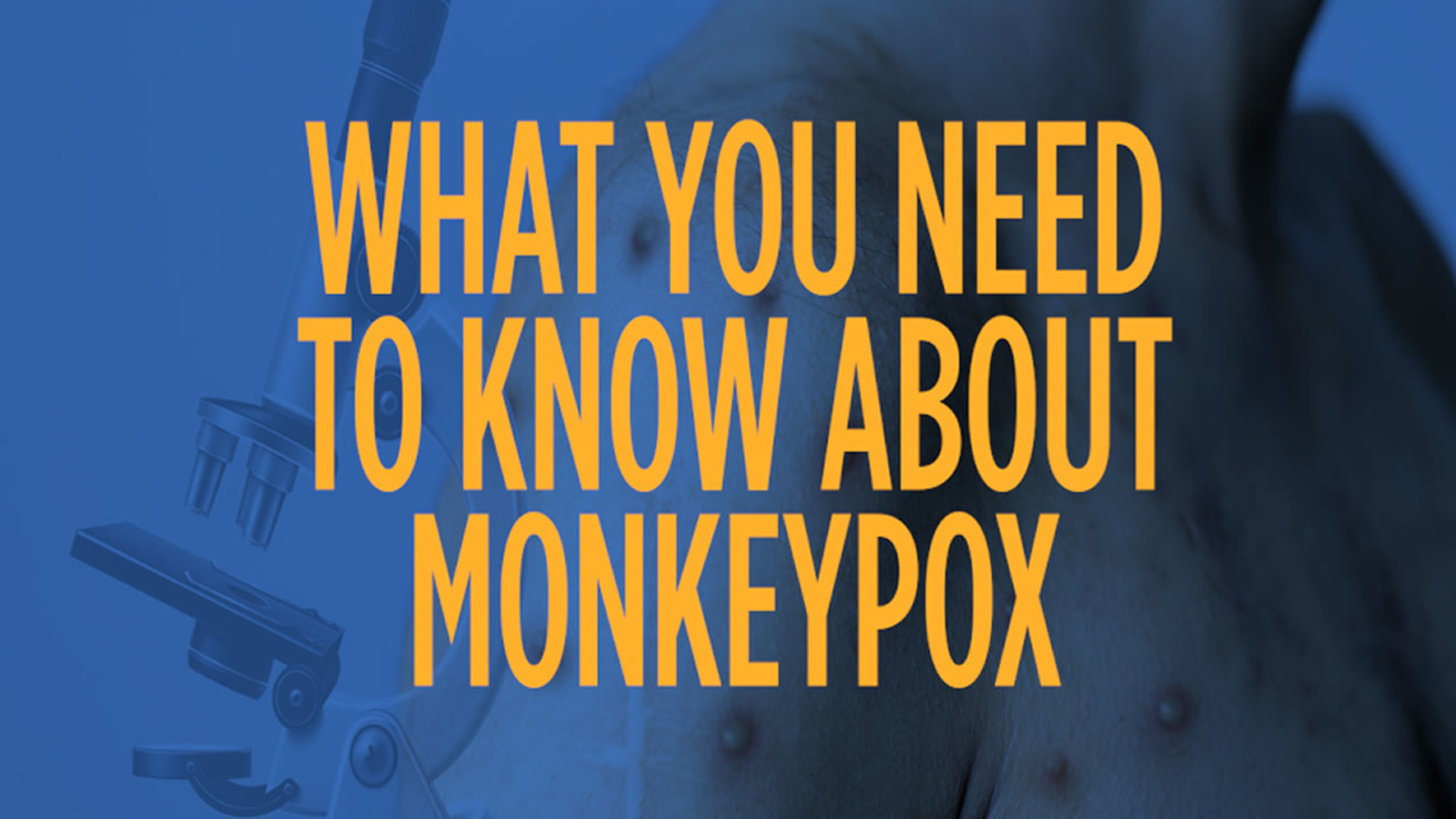 what is monkeypox