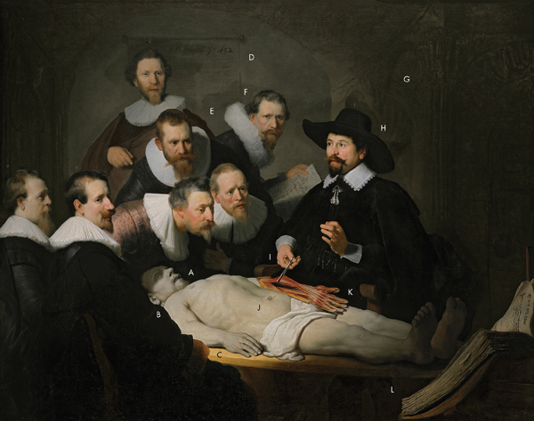 the anatomy lesson of dr. nicolaes tulp