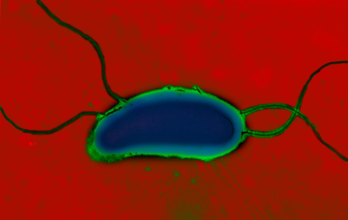 2016–17 yemen cholera outbreak