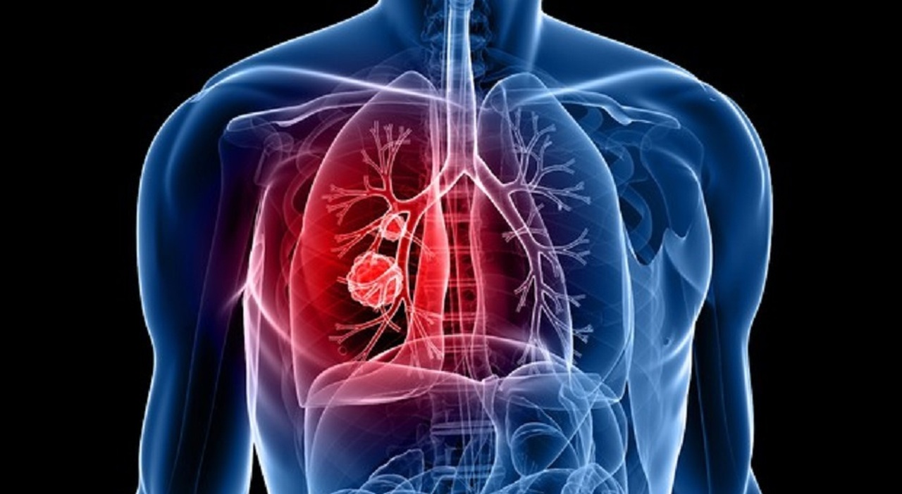 tumore ai polmoni nuovo farmaco