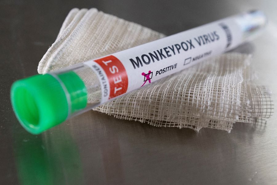 viruela del mono sintomas