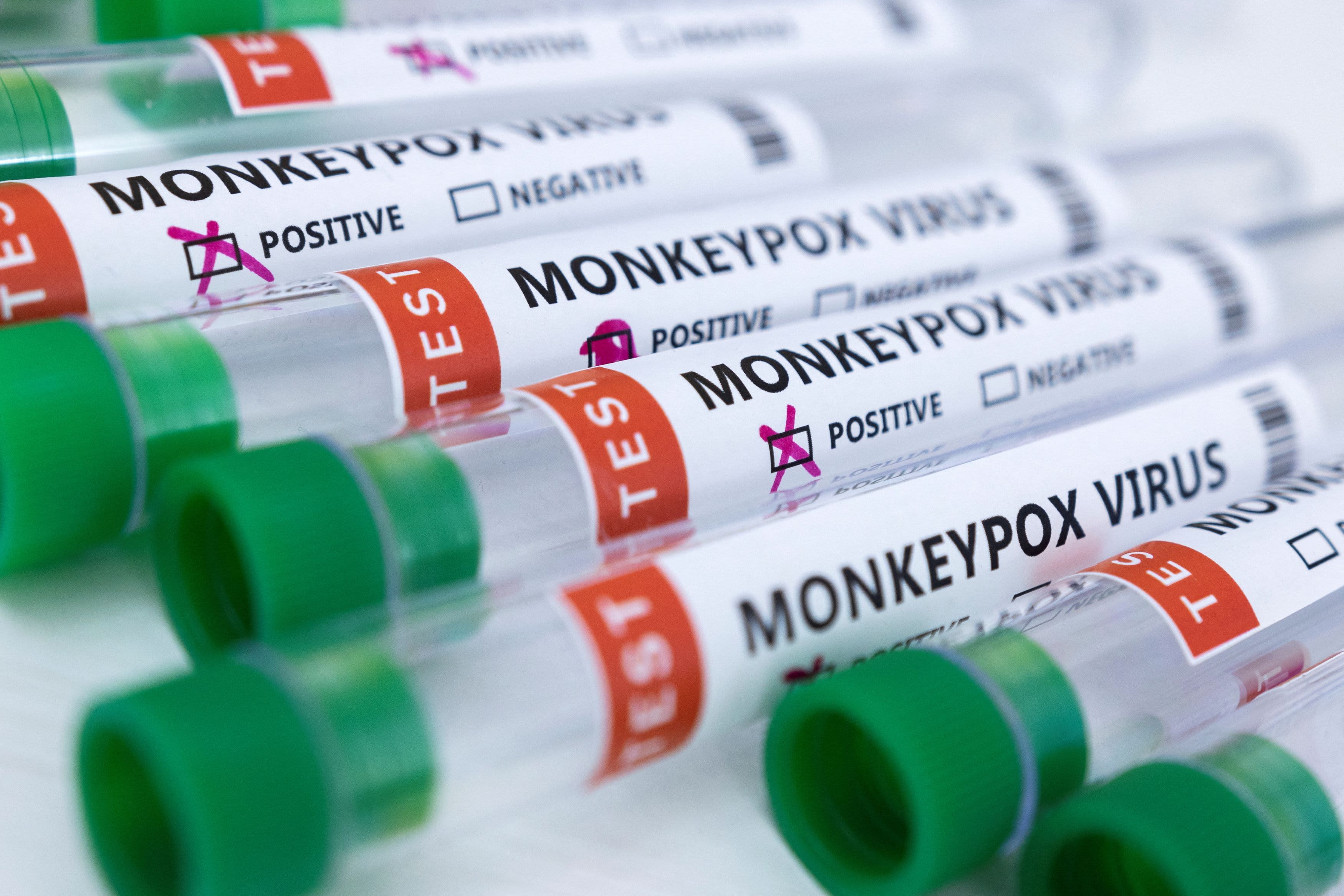 monkeypox virus outbreak symptoms
